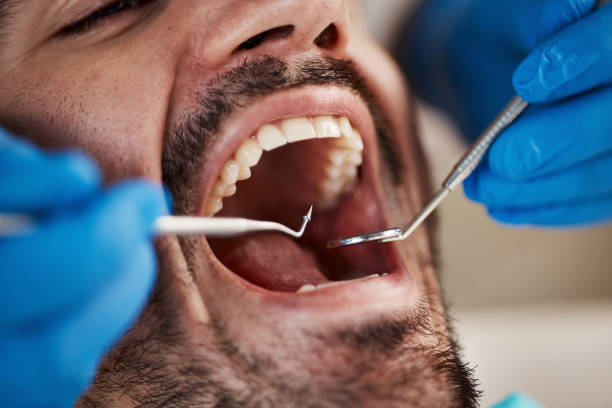 Best Dental Bonding  in Westport, WA